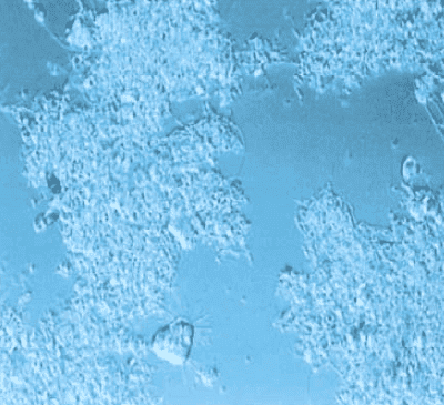 纯氧曝气